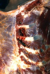 Natural color photograph of dissection of the thorax, anterolateral view, showing the bone structure and musculature of the rib cage