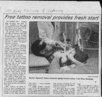 Free tattoo removal provides fresh start