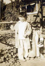 Two Siu boys, when the smallpox vaccine started to take effect