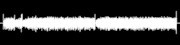 Radio Show Discussion of the ERA