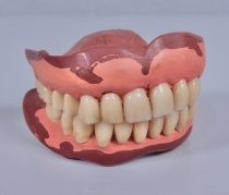 Set of prosthetic teeth