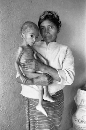 Refugee woman and malnurished child, Chiapas, 1983