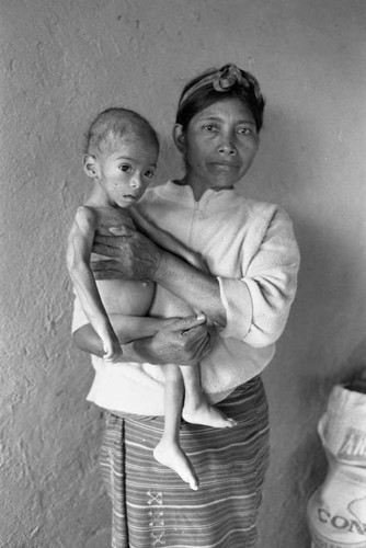 Refugee woman and malnurished child, Chiapas, 1983