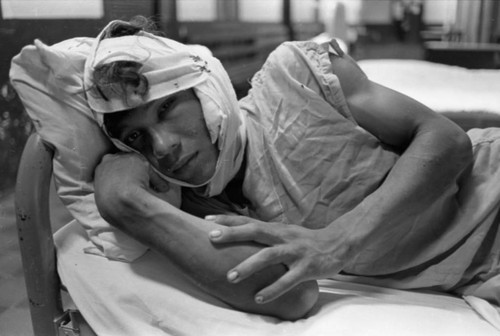 Injured man in bed, Nicaragua, 1979