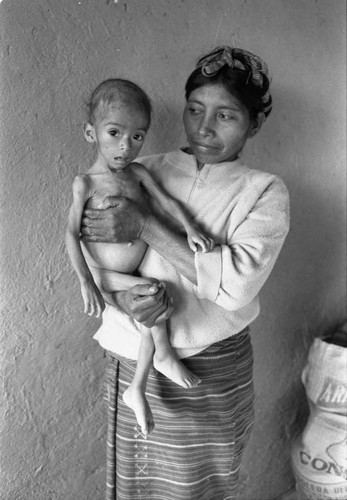 Refugee woman and malnurished child, Chiapas, 1983