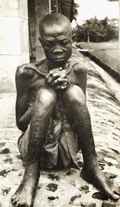 Hospital patient, Nigeria, ca. 1938