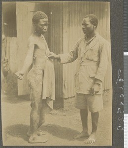 Yaws case, Tumutumu, Kenya, ca.1920