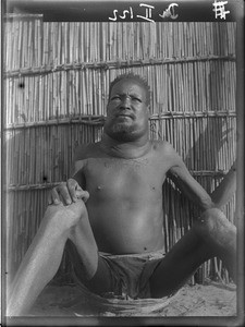 African patient, Matutwini, Mozambique, ca. 1930