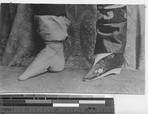 Bound feet covered and uncovered in Dalian, China, 1927