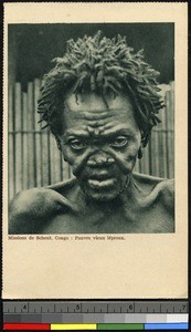 Man with leprosy, Congo, ca.1920-1940