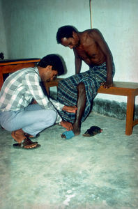 Diasserie, Bangladesh 1990: "Spedalskhed - den gamle svøbe" - Nr. 13: En spedalsk mand får sine ben undersøgt. For at redde patienter fra at få nerveskader, er det vigtigt at have et dygtigt personale. Her er en patient ved at blive undersøgt i forbindelse med behandling for reaktion. Denne behandling skulle gerne medføre, at noget af den mistede styrke i de berørte muskelgrupper, kan genvindes