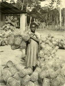 Leprous girl with baskets for cocoa, in Ebeigne, Gabon