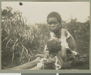 Woman suffering from yaws, Chogoria, ca.1924