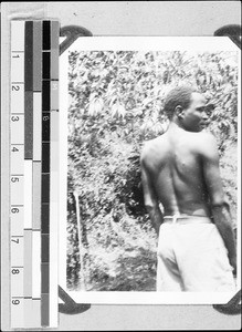 An African leper, Nyasa, Tanzania, ca. 1938