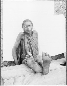 African with jigger flea-bitten feet, Mamba?, Tanzania, ca.1901-1910