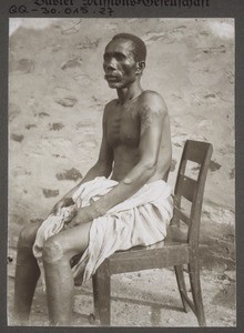 Basel Mission. 46. Man with leprosy, Gold Coast