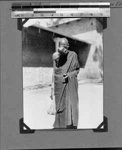 African woman with a large tumor in her face, Isoko, Tanzania, 1929