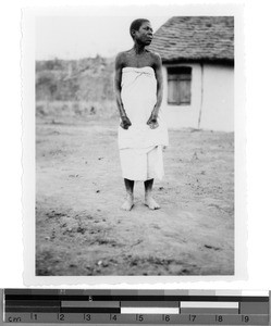 A leprous woman in Sikonge, Tanzania