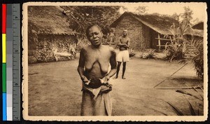 Female leprosy victim showing bandaged fingers, Congo, ca.1920-1940