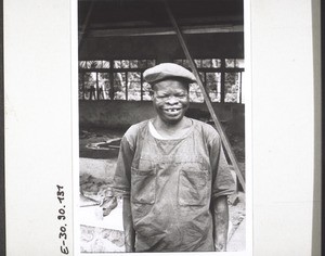 A patient with leprosy in Manyemen