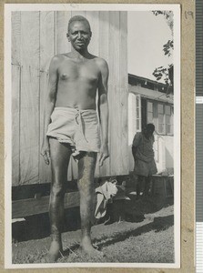 Leprosy patient, Chogoria, Kenya, 1950