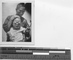 A baby at the Maryknoll Leprosarium at Jiangmen, China, 1936