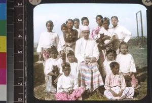 Young leper patients, Mandalay, Myanmar, s.d