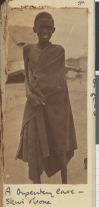 Young patient, Dodoma, Tanzania, July-November 1917