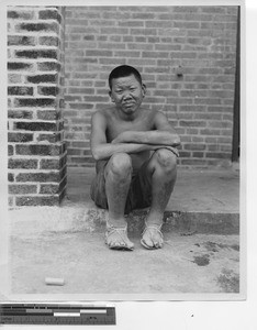 A man at Leprosarium at Jiangmen, China, 1949