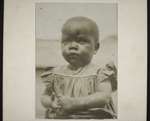 André Nsombo, a motherless boy who is being cared for by the missionary Chapuis (Cameroon)