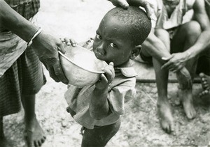 Leprous child, in Ebeigne, Gabon