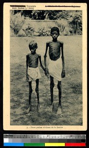 Two boys are victims of famine, Rajasthan, India, ca.1920-1940