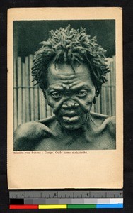 Portrait of a leper, Congo, ca.1920-1940