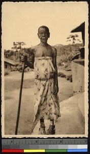 Woman with leprosy, Congo, ca.1920-1940