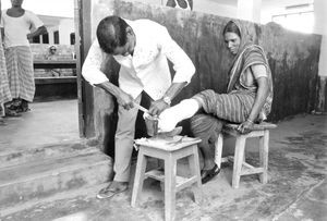 Danish Bangladesh Leprosy Mission/DBLM. Leper patient receiving treatment at Nilphamari Hospita