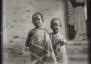 African children with the scars of inherited syphilis on their noses