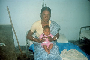 Diasserie, Bangladesh 1990: "Spedalskhed - den gamle svøbe" - Nr. 11: Spedalsk kvinde med barn. Megen overtro er forbundet med spedalskhed, f.eks. at det nedarves. Denne kvinde har et sundt barn, selv om hun har været spedalsk i mange år. En vigtig del af arbejdet består i at oplyse om dette, så spedalskhed erkendes som en sygdom, der i lighed med andre kan behandles