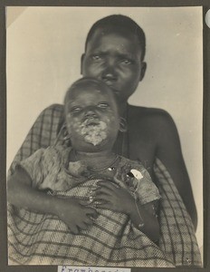 Yaws, Tanzania, ca.1929-1940