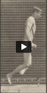 Nude man with single amputation of leg, hopping with crutches