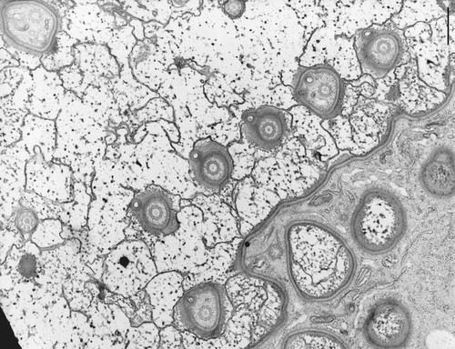 CIL:9832, Nassula, cell by organism, eukaryotic cell, Eukaryotic Protist, Ciliated Protist