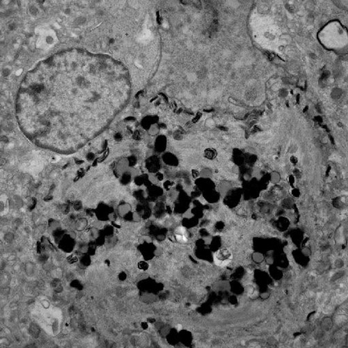 CIL:40184, Homo sapiens, pyramidal cell, neuron of cerebral cortex