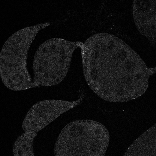 CIL:13740, Drosophila melanogaster, germ line cell, follicle cell, germ line stem cell, follicle stem cell