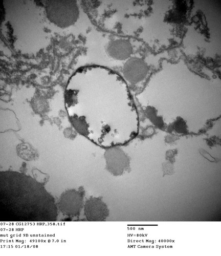 CIL:13473, Drosophila melanogaster, garland cell