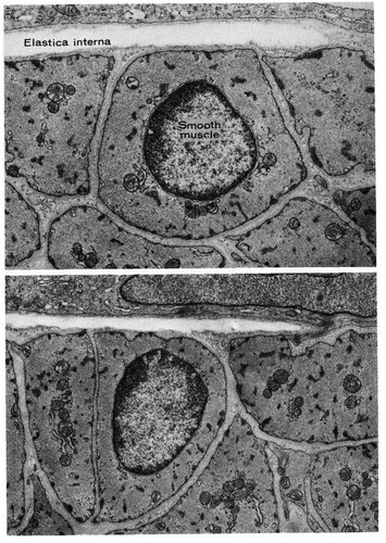 CIL:10951, blood vessel endothelial cell