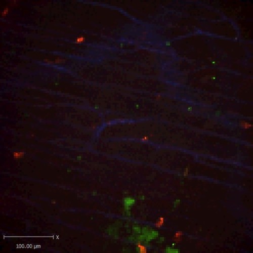 CIL:47579, Staphylococcus aureus, neutrophil, endothelial cell