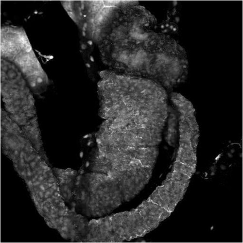 CIL:12580, Spiroplasma kunkelii, Dalbulus maidis, prokaryotic cell