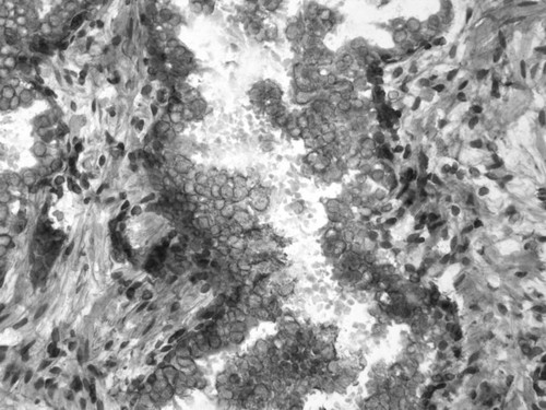 CIL:34061, Homo sapiens, endocrine-paracrine cell of prostate gland, basal cell of prostate epithelium, luminal cell of prostate epithelium, blood vessel endothelial cell, perineural cell, sheath cell, leukocyte, prostate stromal cell, smooth muscle cell of prostate