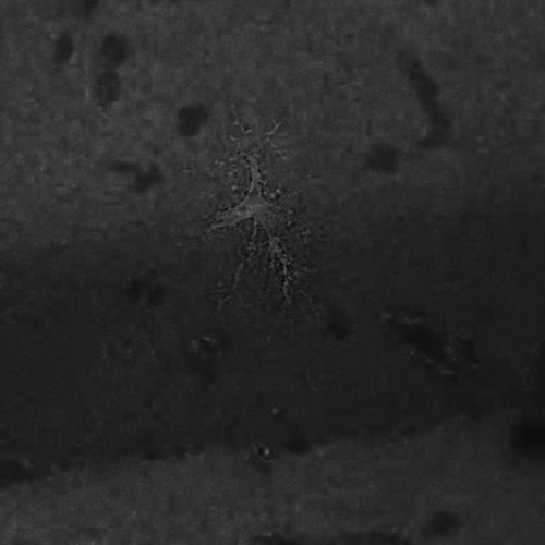 CIL:40000, Rattus norvegicus, astrocyte, astrocyte of the hippocampus