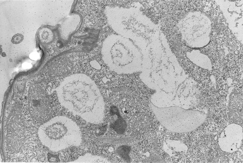 CIL:2862, Colpoda cucullus, cell by organism, eukaryotic cell, Eukaryotic Protist, Ciliated Protist