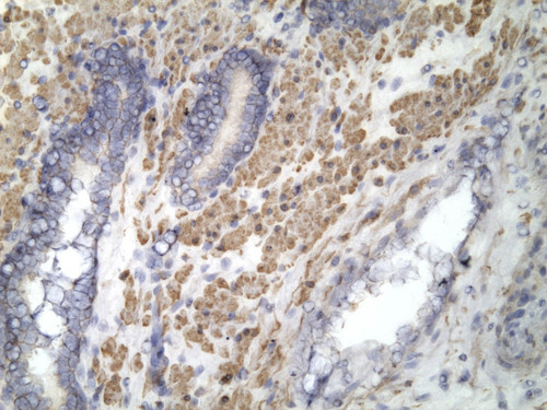 CIL:33463, Homo sapiens, endocrine-paracrine cell of prostate gland, basal cell of prostate epithelium, luminal cell of prostate epithelium, blood vessel endothelial cell, perineural cell, sheath cell, leukocyte, prostate stromal cell, smooth muscle cell of prostate